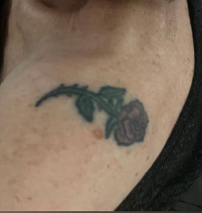 Fixups / Coverups — IMG